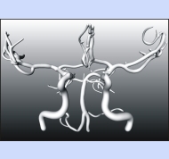 Oeltze: Visualisation of a cerebal blood vessel tree.